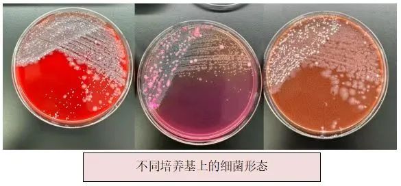 【医学科普】“微”急送出 久盼归来