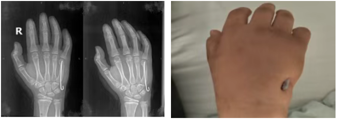 微信图片_20260115075825