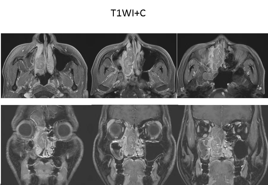 8fb4d60ac46edb5e9abcbc0299d749f